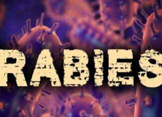Rabies Alert in La Plata & Surrounding Areas – Stay Informed for Safety rabies-alert-in-la-plata-surrounding-areas-stay-nformed-for-safety